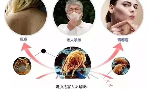 「健康」涼席放了一整年養(yǎng)肥了螨蟲？2個小工具，2分鐘徹底清除