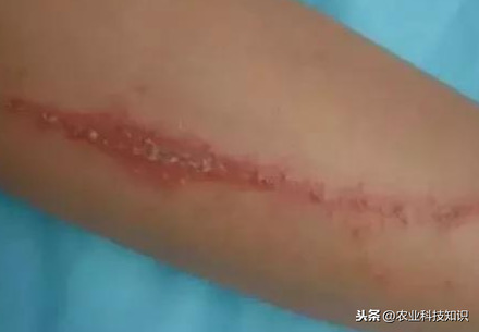 這蟲子可是個狠角色，惹不起，躲著走