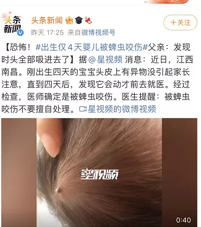 家中的小孩被蜱蟲咬了怎么辦？如何對付蜱蟲？
