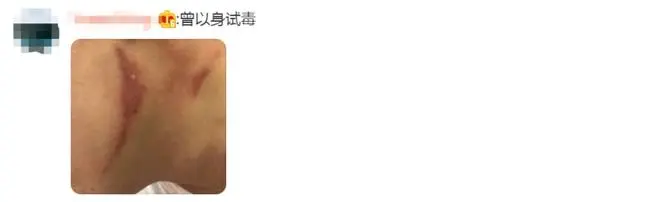 別再關(guān)燈玩手機(jī)了！這種蟲(chóng)會(huì)毀容！切記不要拍......
