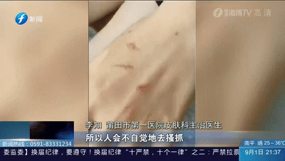 別再關(guān)燈玩手機(jī)了！這種蟲(chóng)會(huì)毀容！切記不要拍......