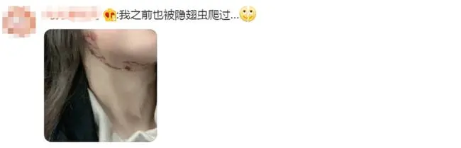 別再關(guān)燈玩手機(jī)了！這種蟲(chóng)會(huì)毀容！切記不要拍......