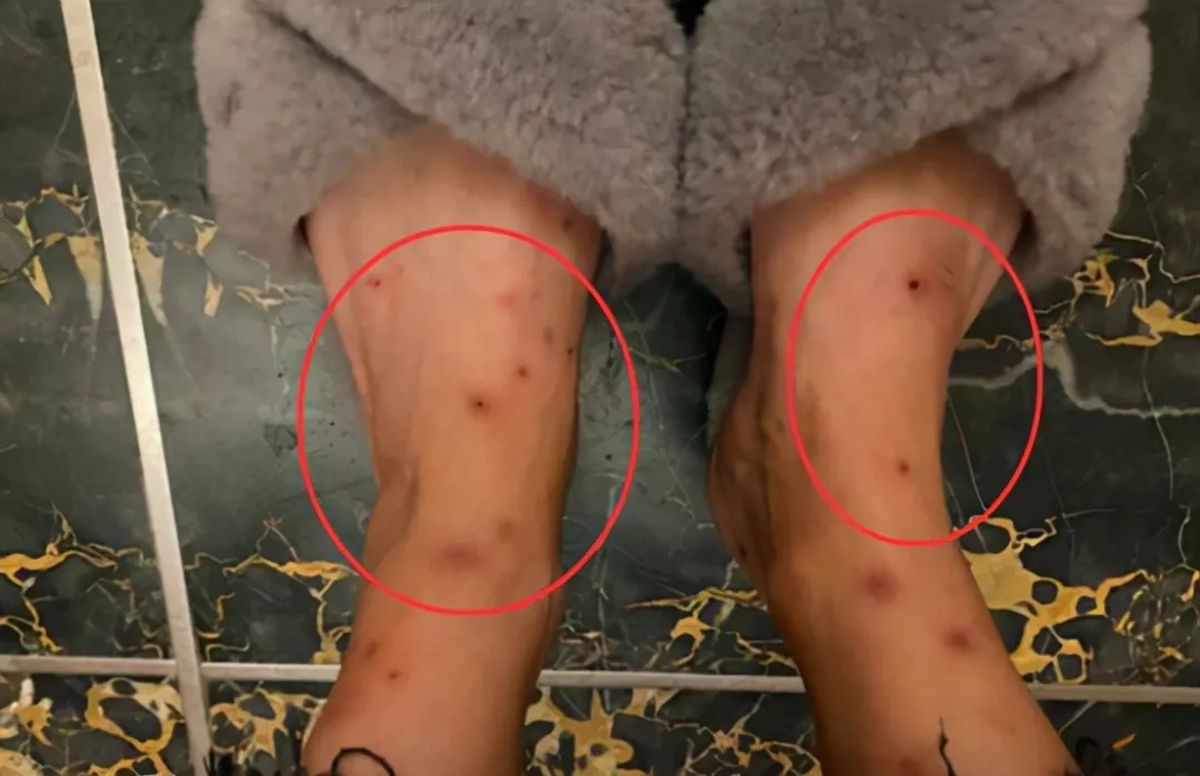 一小區(qū)跳蚤泛濫！跳蚤究竟哪來的？